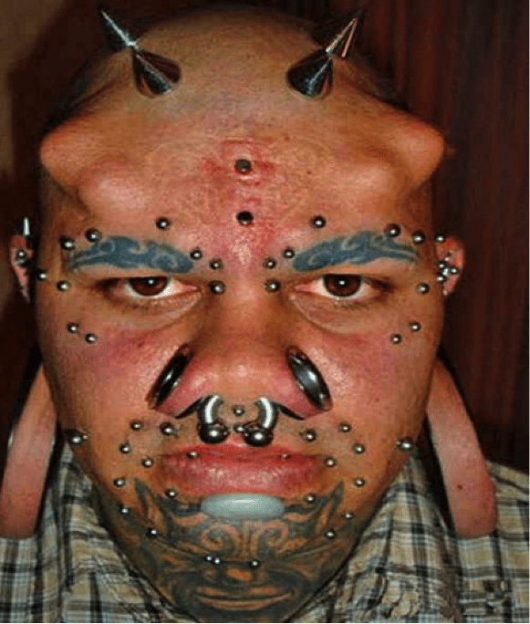 TrendMantra article_416_12 13 Most Obnoxious Body Piercings Of All Time. Not For The Weak Hearted. 
